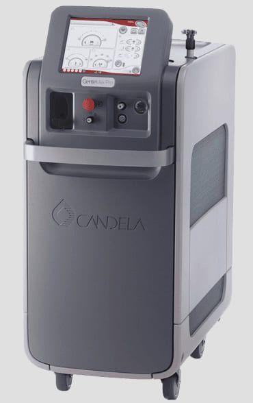 Лазер CANDELA